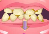 Orthodontiste Pour Filles